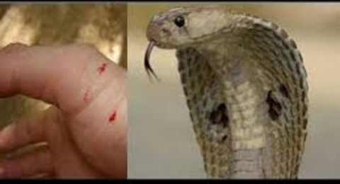 Snake Bite First Aid