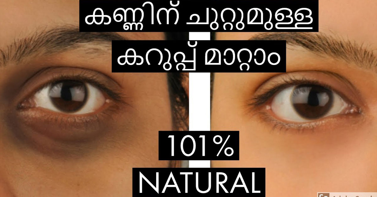 remove dark circles