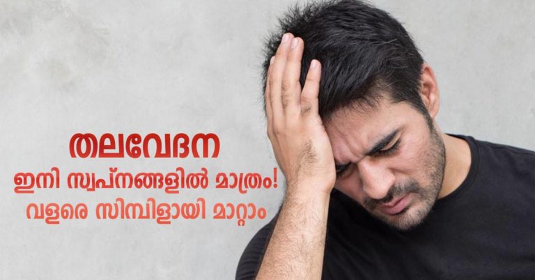 Home Remedies for Migraine