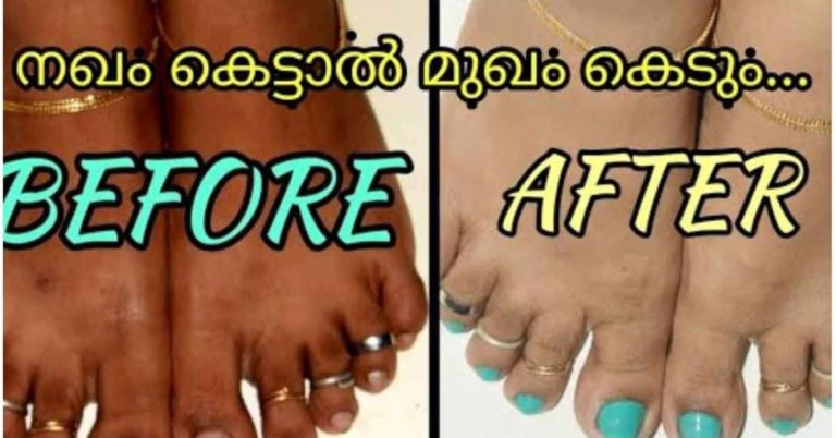 how to pedicure at home at zero cost