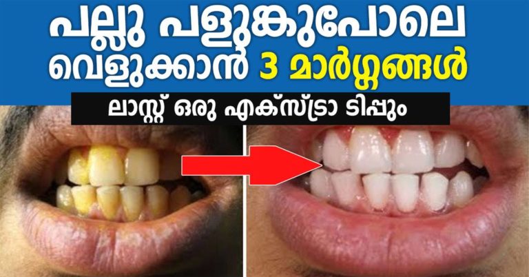 How to Whiten Teeth With Baking Soda