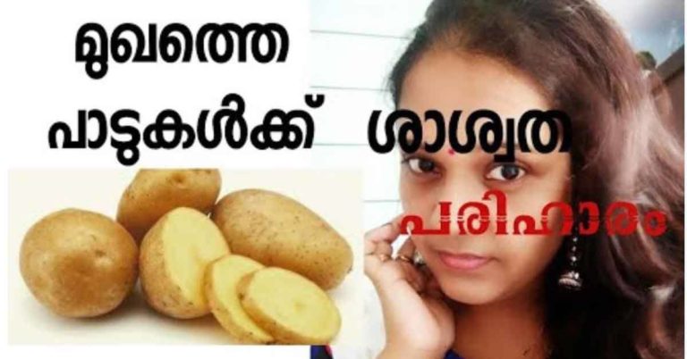 Potato facial