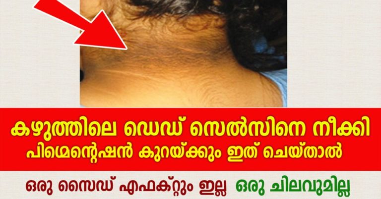 Home Remedies For A Dark Neck