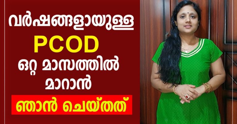 10 NATURAL TREATMENTS FOR PCOS