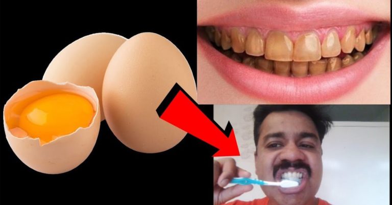 TEETH WHITENING WITH EGG