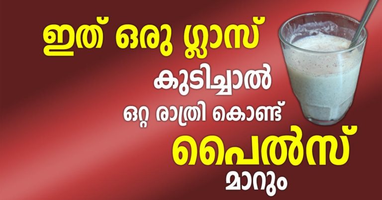 Home Remedies for Hemorrhoids