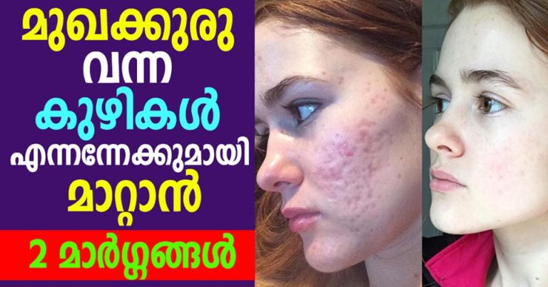 7 Natural Face Packs Our Grandmothers Used for Beautiful Skin