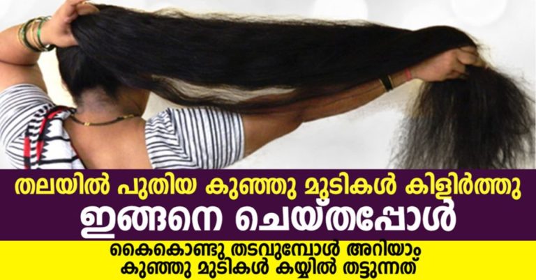 Onion For Hair – 10 Hair Health Benefits & Tips To Use It For Hair Growth