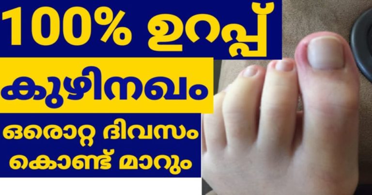 How to remove toenail fungus only 1 day