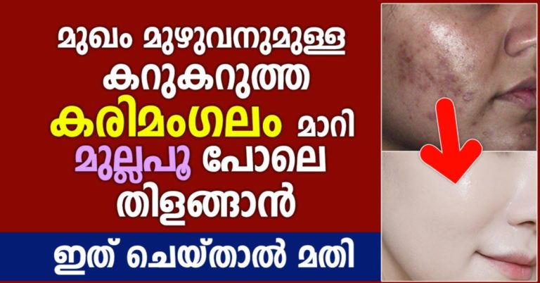 6 Best Face Packs for Skin Hyper Pigmentation Removal In India