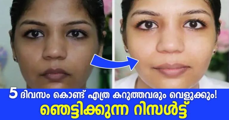 skin whitening tips..