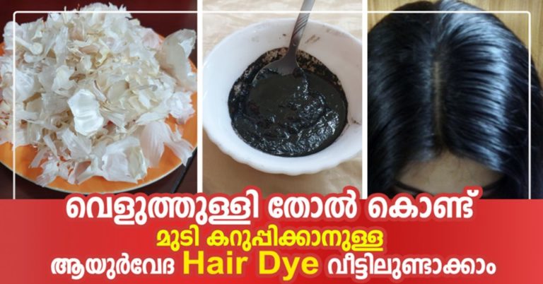 How You Can Use Garlic For Hair Growth: Tips And Benefits