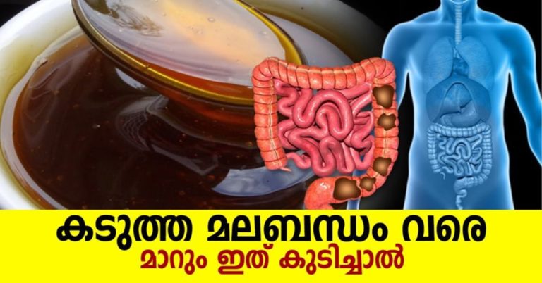 Effective Home Remedies for Constipation