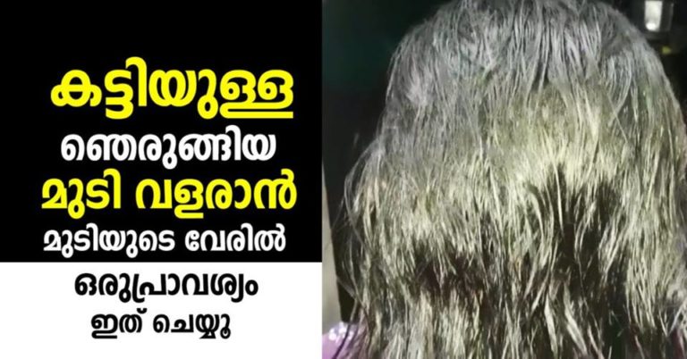 BEST HOME REMEDIES FOR HAIR GROWTH