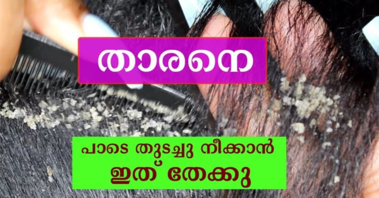 It can be used to wipe away dandruff completely