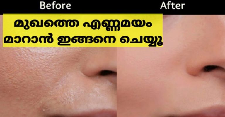 HOW TO GET RID OF OILY SKIN WITH HOME REMEDIES