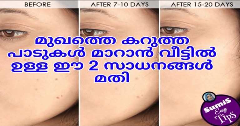 DIY Natural Remedies: How to Get Rid of Dark Spots on Face