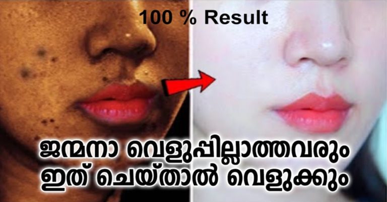 Best Face Packs For Skin Lightening