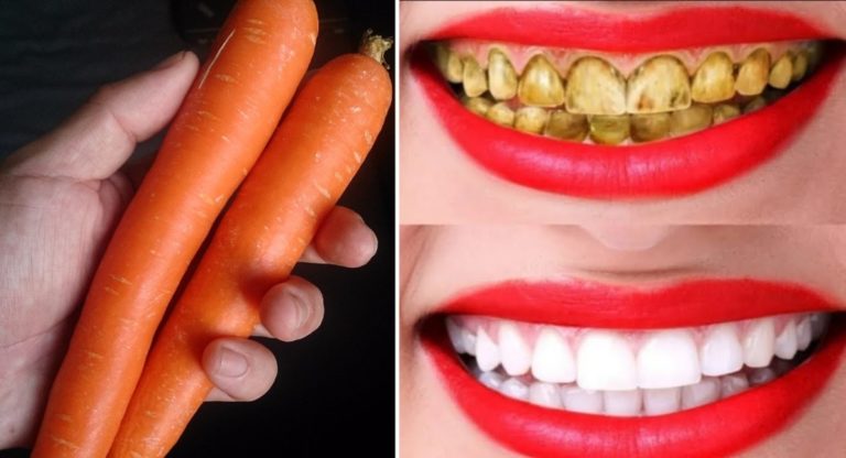 tips to whiten your teeth naturally at home
